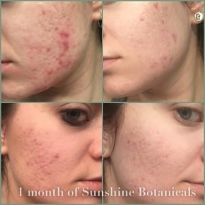 Skin Cleansing: The Missing Link in Corrective Skin Care