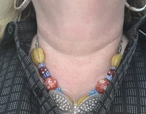 Horizontal Lines on the neck