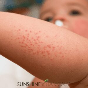 Jewelweed scrapes, rashes 