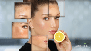 Treating skin discoloration is a big business in spas and skincare clinics and is growing tremendously by the day! 