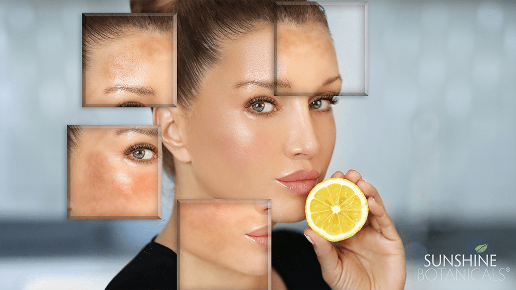 Clinical Skin Care – From a Botanical Perspective