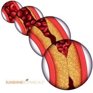 Are Vinegar, Cholesterol, and Heart Health Connected?