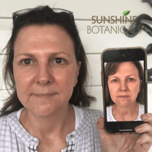 MySkinBuddy Results