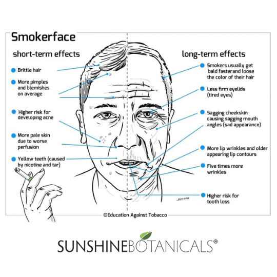 Man's Smoker Face Stop smoking:<br />
Tobacco smoke contains deadly carcinogens that lead to a "smoker's face." Signs of a smoker's face include dull and dry complexion, grayish tint, premature lines and wrinkles, and leathery skin.